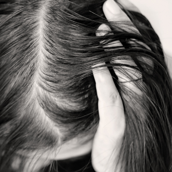 HAIR THINNING